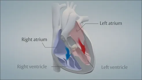 Video thumbnail: Get to Know 2 Types of Heart Valve Disease