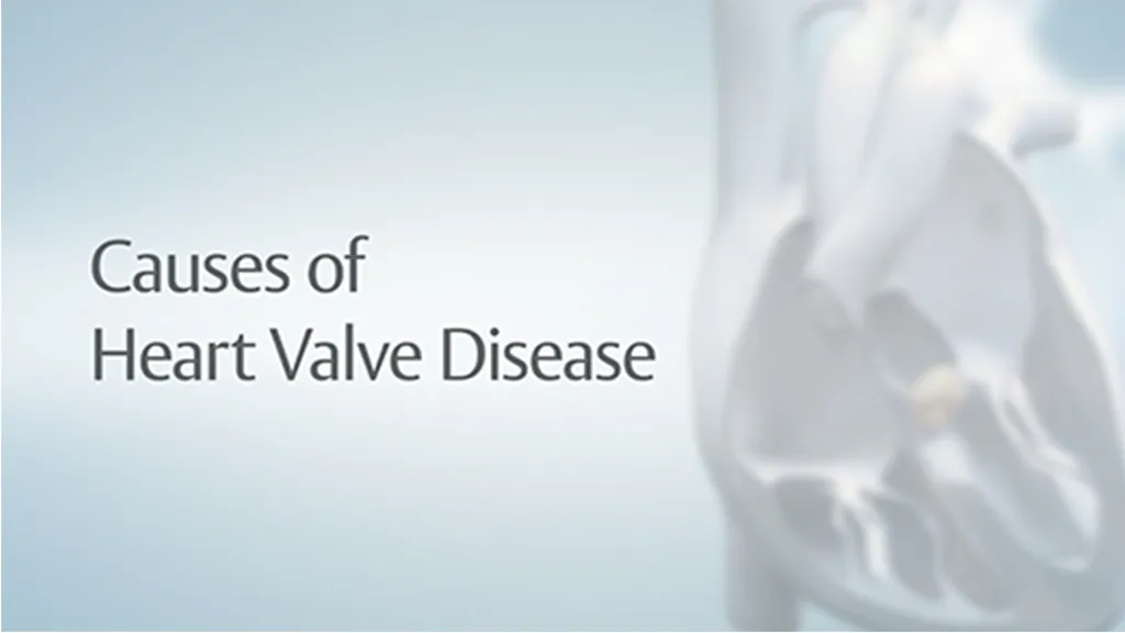 Video Thumbnail: What You Need to Know About Heart Valve Disease