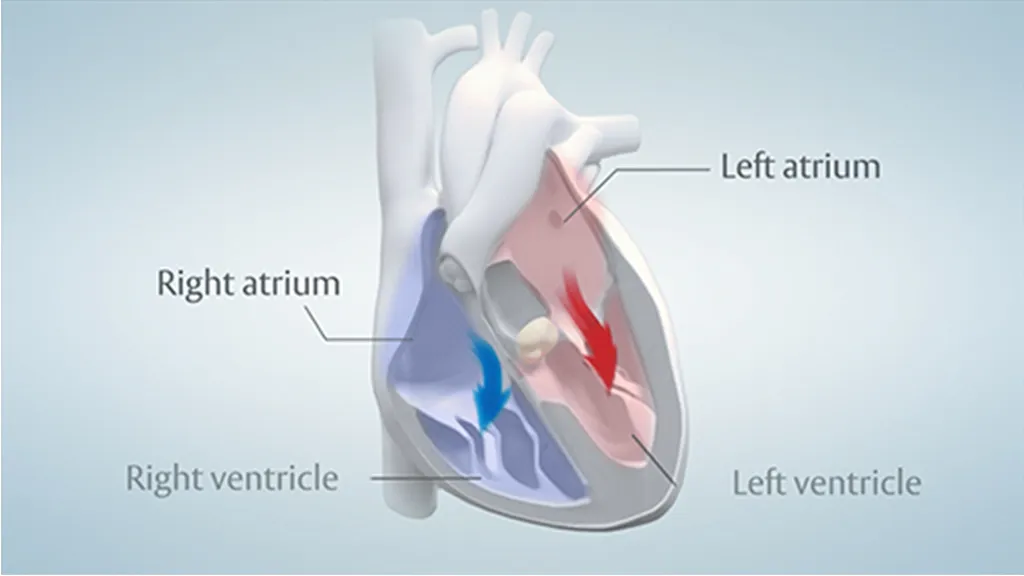 Video thumbnail: GET TO KNOW 2 TYPES OF HEART VALVE DISEASE