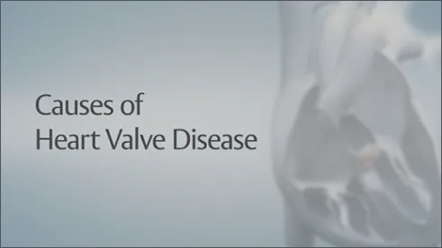 Video thumbnail: WHAT YOU NEED TO KNOW ABOUT HEART VALVE DISEASE