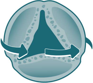 Graphic of a restored heart valve after valve replacement